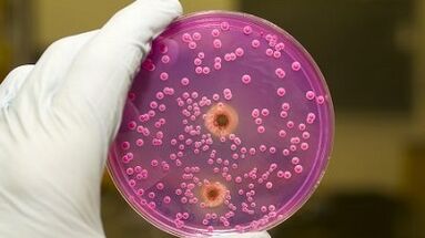 Patološki izcedek pri moških, ko je navdušen